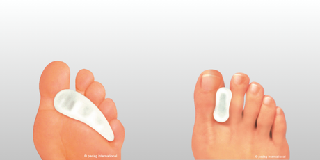 Comprehensive Guide to Hammer Toe Treatment